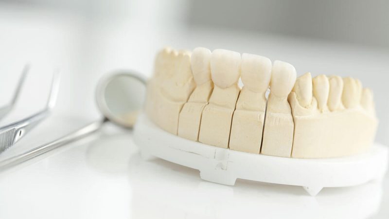 Dentalspiegel neben einem Gebissmodell mit künstlichen Zähnen